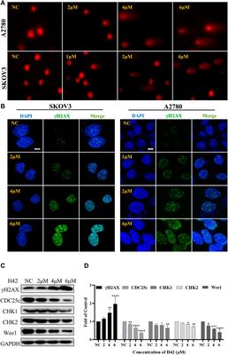 Identification of a novel pyridine derivative with inhibitory activity against ovarian cancer progression in vivo and in vitro